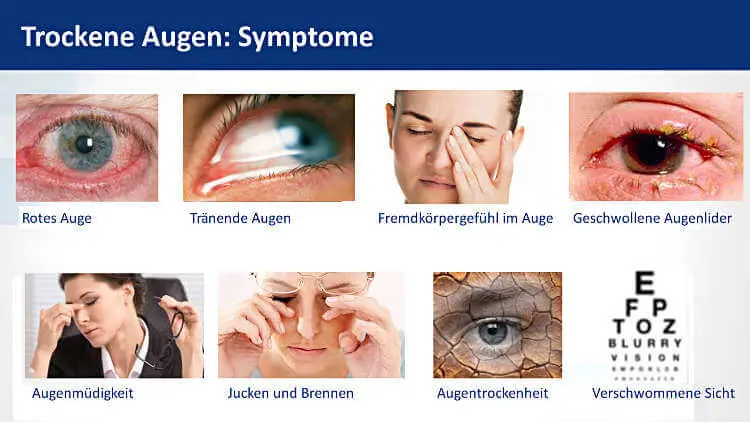 Übersicht: rote und tränende Augen, Fremdkörpergefühl, geschwollene Lider, Augenmüdigkeit, Jucken, Brennen und verschwommenes Sehen